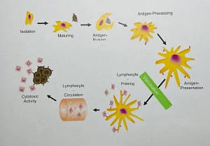Proven Dendritic cell vaccines for cancer in Germany